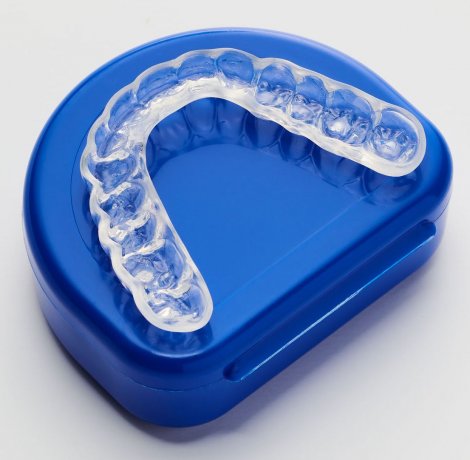 Night Guard (Bruxism)