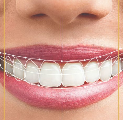 Digital Smile Design